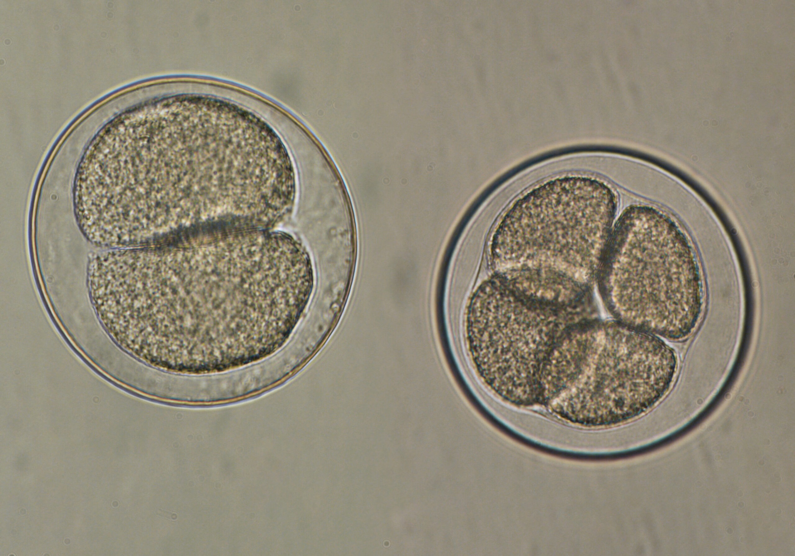 IVF Embryo Culture Media: The Key to Successful In Vitro Fertilization
